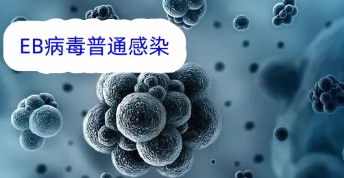 EB病毒.jpg